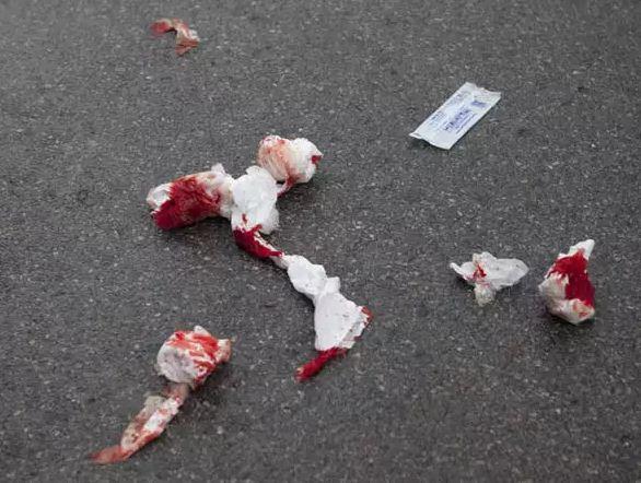 ضمن طقوس دينية غريبة: شاب  يقطع عضوه الذكري ويأكله أمام والديه