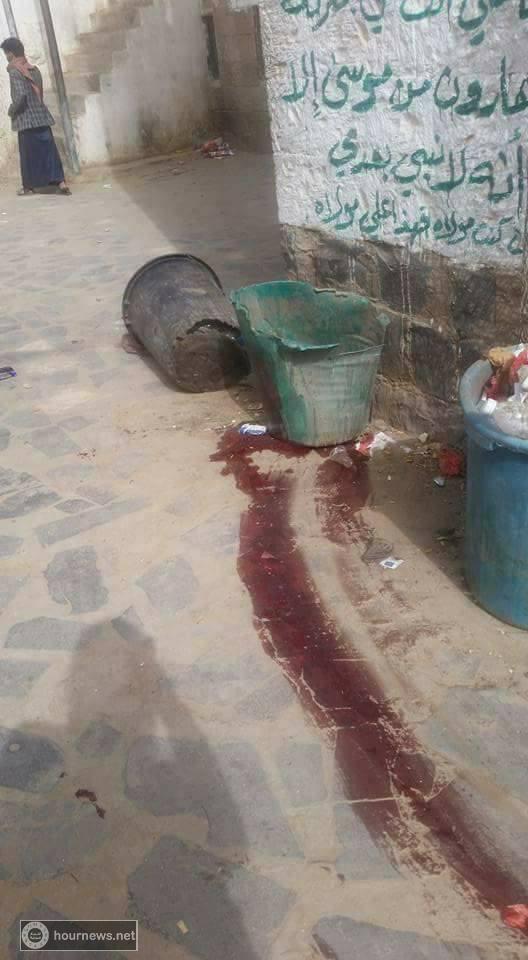 اليمن :تحديث جديد لأحداث السجن المركزي بصنعاء (صور+ فيديوهات) اليمن :تحديث جديد لأحداث السجن المركزي بصنعاء (صور+ فيديوهات)