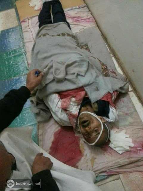 اليمن : شاب يقتل والدة في الرجم بمحافظة المحويت (صورة)