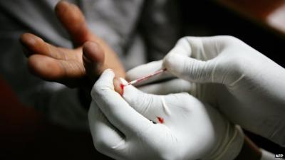 وسط هلعٍ شديد .. سكان دولة عربية يتدافعون على مراكز فحص “الإيدز” لسبب غريب!
