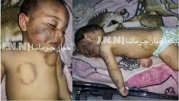 شاهد بالصور :من لم يمت برصاص الحرب مات بسلاح الجنون” .. أبّ سوري يقتل طفلته “عضاً”