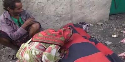 اليمن : طيران السعودية يقصف نازحين في تعز مخلفا اكثر من 21 قتيل بينهم نساء واطفال