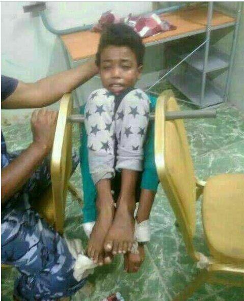 صحفي أمريكي يسرب صورةً لتعذيب أطفال في سجون المكلا السرية التي تديرها الإمارات