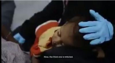 اليمن :شاهد بالفيديو مواطن يمني ماتت طفلته بين يدية ولم يستطيع علاجها بسبب الحرب (يستحق المشاهده)