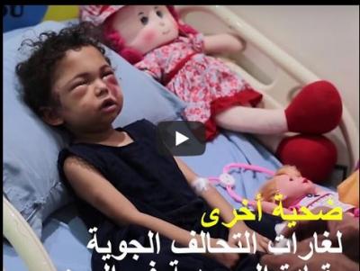 اليمن : العفو الدولية تكشف عن نوع القنبلة والدولة المصنعة لها التي قصفت عائلة الطفلة بثينة الريمي بعطان