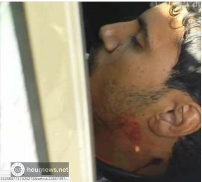 اليمن : اغتيال قيادي حوثي في جولة ريماس بصنعاء (صوره)