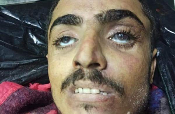 مقتل القيادي  عبدالوهاب محمد علي الحوثي على يد قوات الجيش في الحديدة 