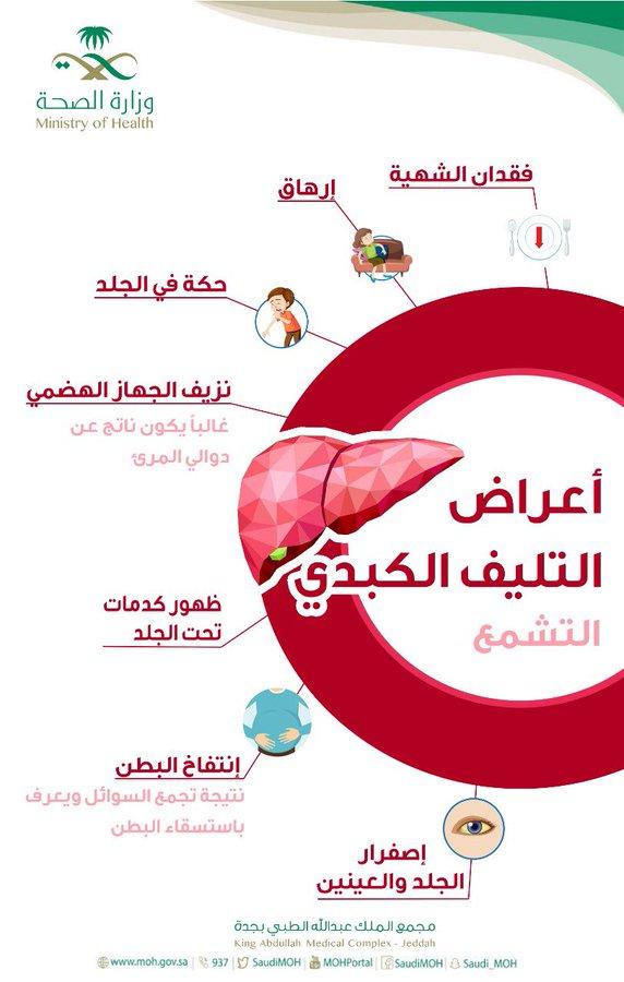 7 أعراض تنذر بوجود تليف الكبد!