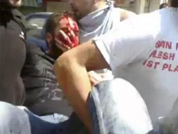 أطباء يطالبون بتحقيق قضائي حول منع علاج مصابين في حلب