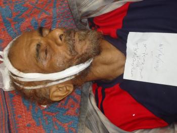 اسماء وصور الشهداء والمصابين في تعز19سبتمبر في مسيرة سلميه 