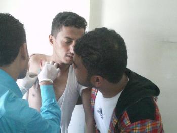 إصابة مراسل أخبار الساعه في مسيرة سلميه بتعز